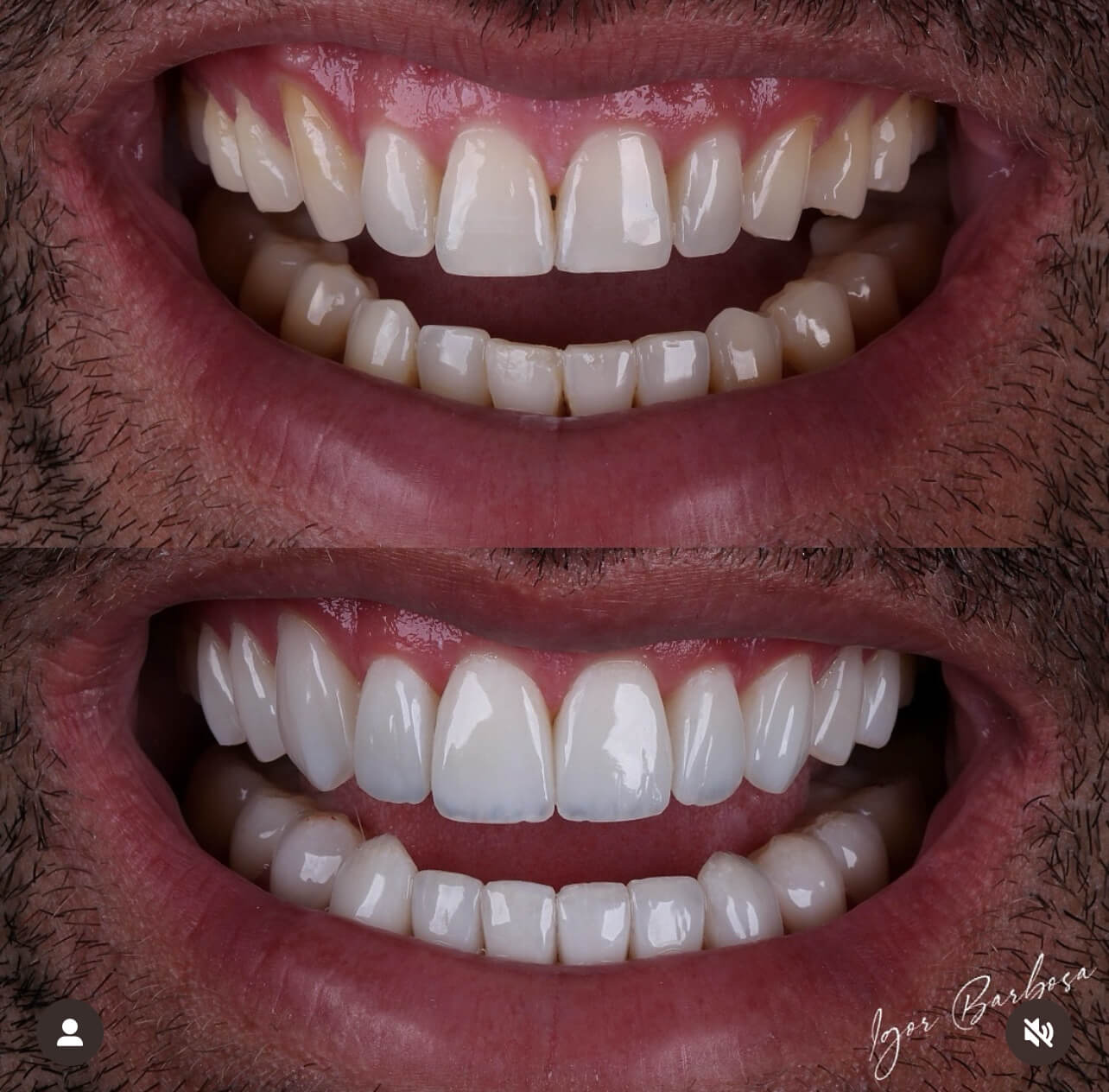 IMG_2EC4DB114F3F-1 (1)