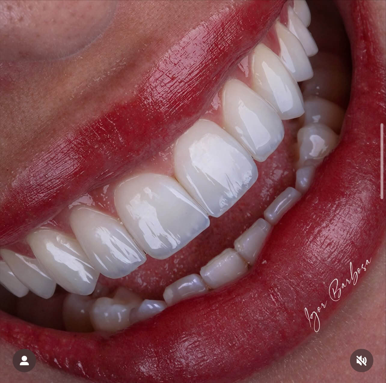 IMG_91890FE334A2-1 (1)