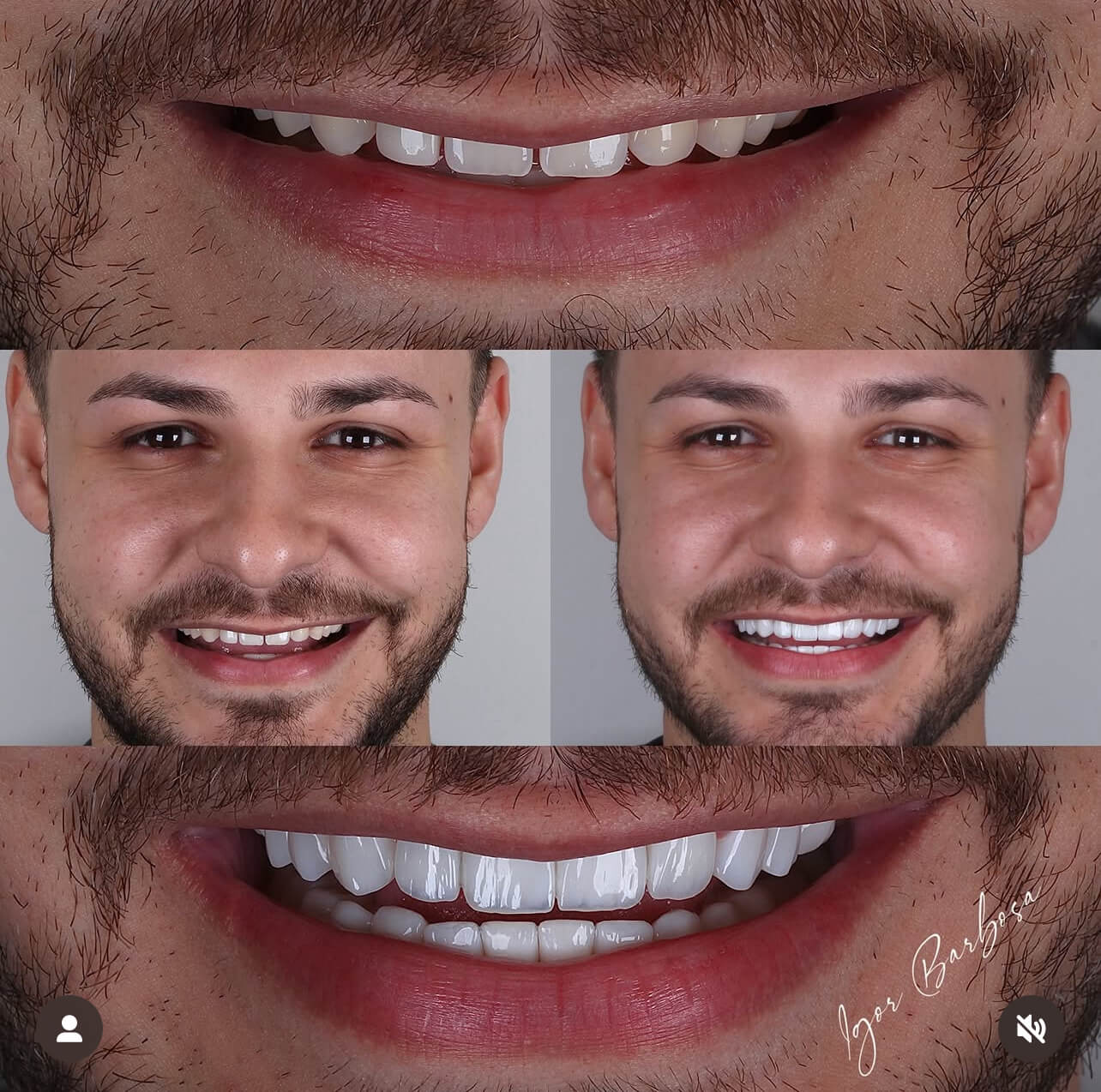 IMG_95B782CD000A-1 (1)