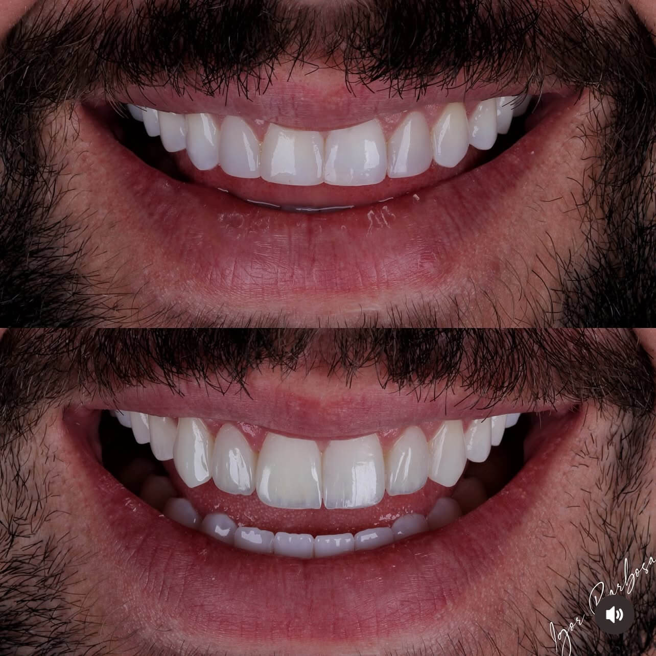 IMG_BD938436BB20-1 (1)